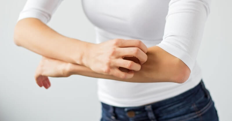 Ayurvedic Treatment for Psoriasis at Vaidya Health Care