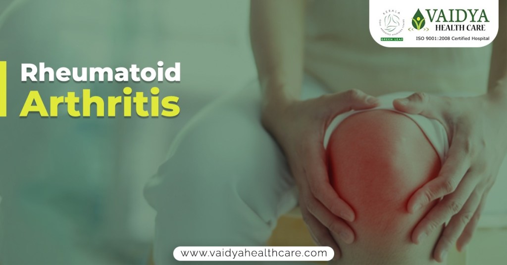 Rheumatoid Arthritis ayurvedic treatment in Kerala at Vaidya Health Care