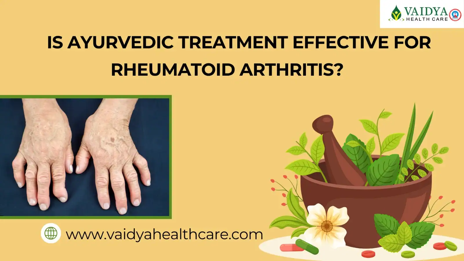 Ayurvedic Treatment For Rheumatoid Arthritis at Vaidya healthcare -